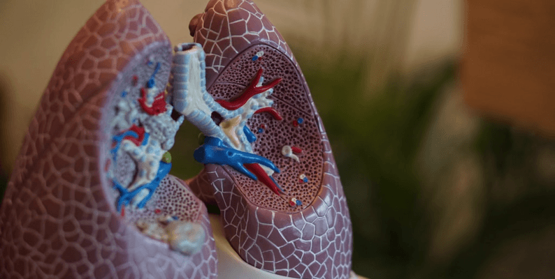 Lung Cancer Prediction Lung Cancer Prediction